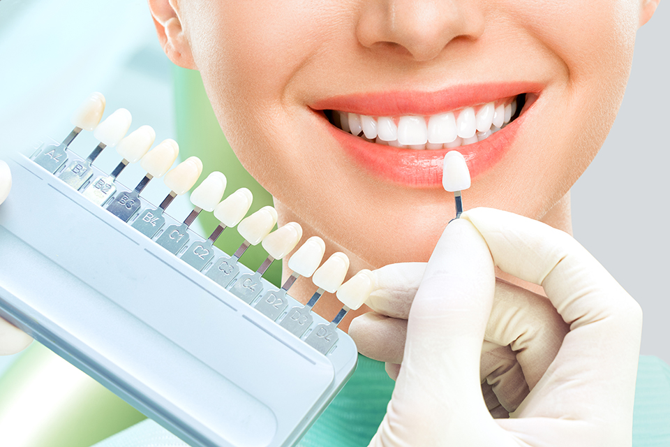 Close up portrait of Young women in dentist chair, Check and select the color of the teeth. Dentist makes the process of treatment in dental clinic office. Teeth whitenning dentiste esthetique dentifree